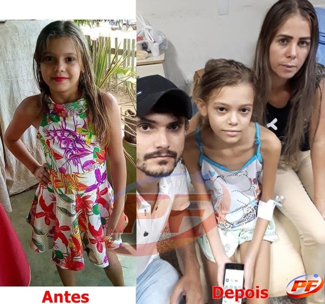 Família de Ji Paraná pede ajuda para manter a pequena Renata em Porto Velho Rondoniareal